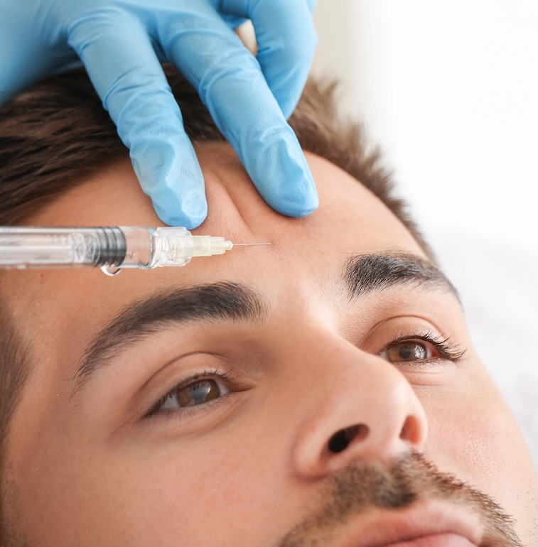 Tratamiento con toxína botulínica para arrugas de entrecejo