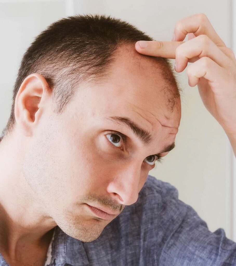 Hombre analizando entradas y caída de pelo