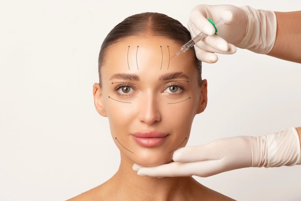 Zonas tratamiento con toxina botulínica bótox Barcelona