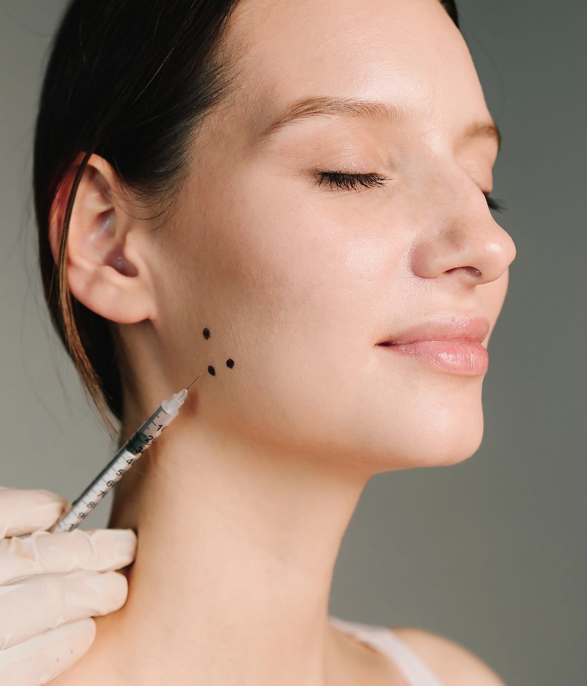 Tratamiento de bruxismo con bótox (toxina botulínica) en mujer