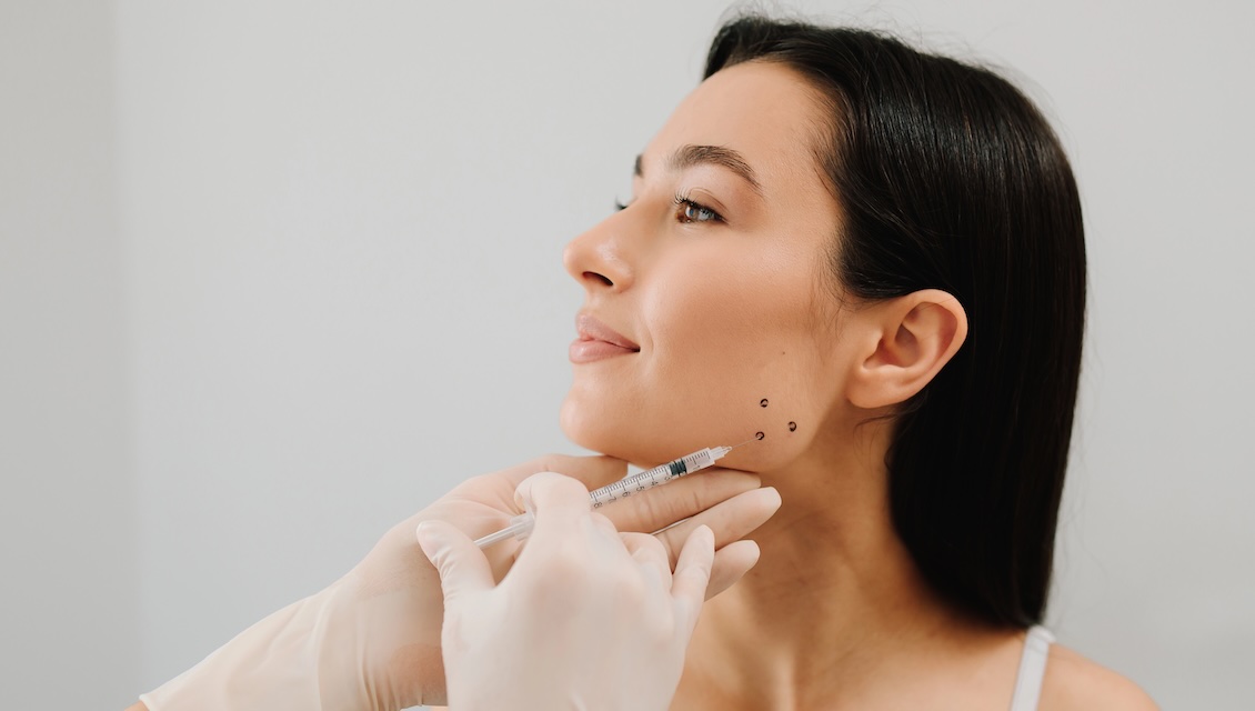 Tratamiento de bruxismo con bótox (toxina botulínica) en mujer