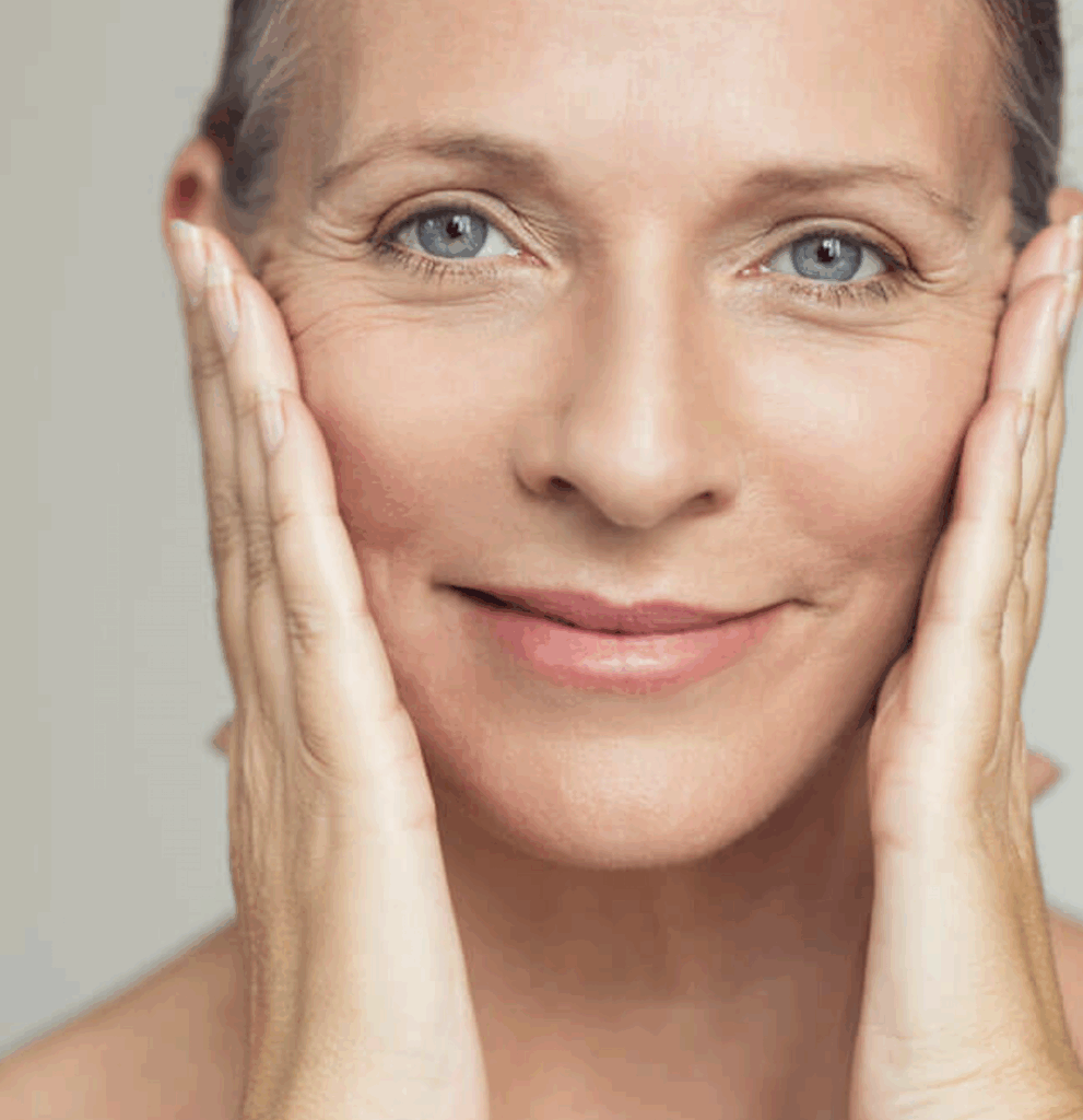 Mujer tras definición natural facial con Radiesse bioestimulador de colágeno en barcelona