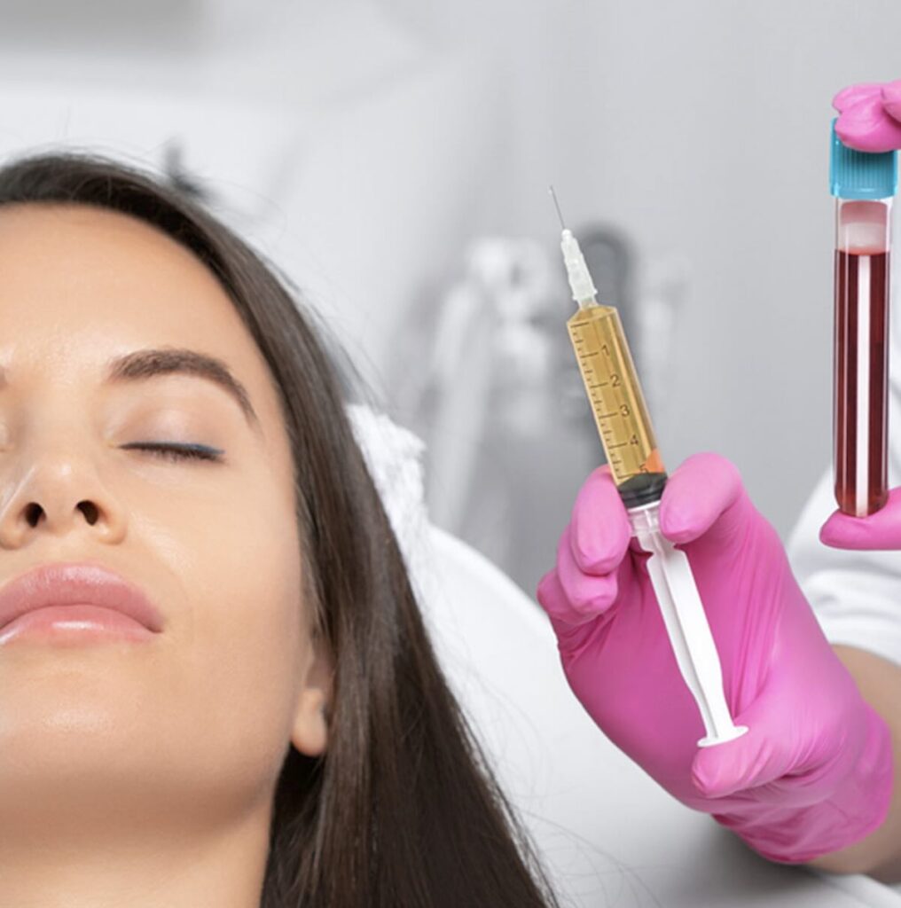 Plasma rico en plaquetas (PRP) con paciente en camilla en clínica de Barcelona recibiendo tratamiento