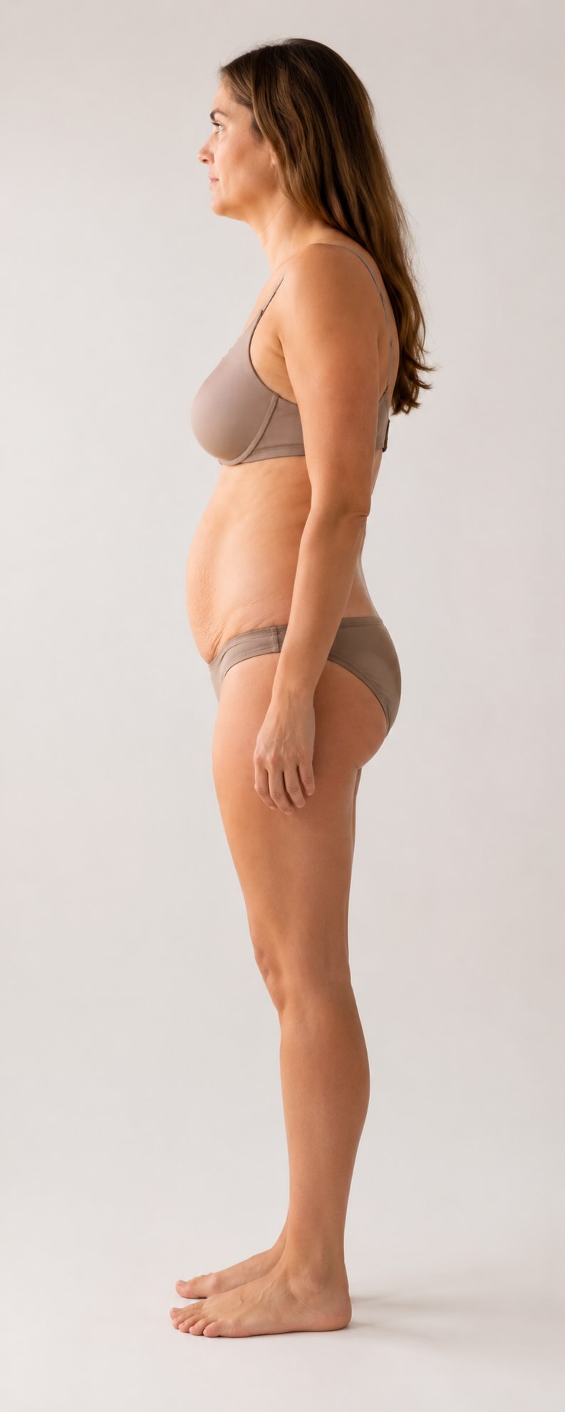 Flacidez abdominal leve-moderada candidata a tratamiento con Lanluma X