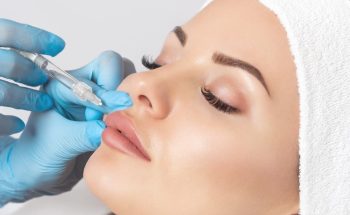 aumento-labios-acido-hialuronico4 Aumento de labios con ácido hialurónico en Barcelona