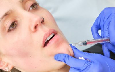 botulinum-toxin-mesotherapy-on-the-chin-2023-11-27-05-00-50-utc