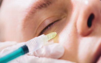 injectable-tissue-stimulator-on-man-face-in-beauty-2023-11-27-05-11-10-utc